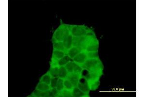 Immunofluorescence of purified MaxPab antibody to CHD9 on 293 cell. (CHD9 antibody  (AA 1-119))