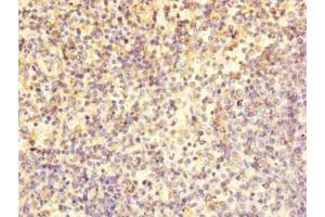 Immunohistochemistry of paraffin-embedded human spleen tissue using ABIN7171457 at dilution of 1:100 (LY9 antibody  (AA 160-360))