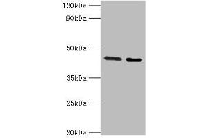 Western blot analysis of Jurkat whole cell lysate (Lane 1) and Rat liver tissue (Lane 2) with CHRFAM7A Antibody (3 ug/ml) and Goat Anti-Rabbit polyclonal antibody (1/10000 dilution). (CHRFAM7A antibody  (AA 1-150))