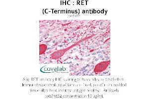 Image no. 1 for anti-Ret Proto-Oncogene (RET) (C-Term) antibody (ABIN5693697) (Ret Proto-Oncogene antibody  (C-Term))