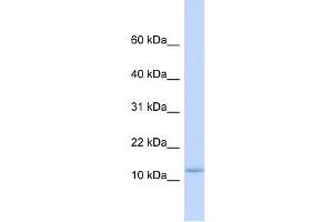 C9ORF46 antibody used at 1 ug/ml to detect target protein. (PLGRKT antibody  (Middle Region))