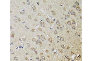 Immunohistochemistry of paraffin-embedded Rat brain using CHN1 Polyclonal Antibody at dilution of 1:100 (40x lens). (CHN1 antibody)