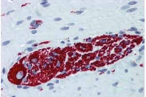 Human Small Intestine, Myenteric Plexus: Formalin-Fixed, Paraffin-Embedded (FFPE) (Peripherin antibody  (AA 374-471))