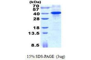 Figure annotation denotes ug of protein loaded and % gel used. (MYD88 Protein)