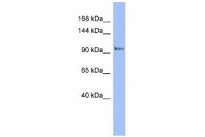 PI4KB antibody used at 1 ug/ml to detect target protein. (PI4KB antibody  (N-Term))