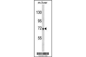 Western blot analysis of AMOTL2 Antibody in mouse liver tissue lysates (35ug/lane)