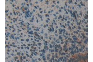 Detection of ANXA2 in Mouse Uterus Tissue using Polyclonal Antibody to Annexin A2 (ANXA2) (Annexin A2 antibody  (AA 1-339))