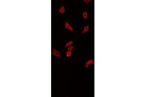 ABIN6268871 staining PC-12 cells by IF/ICC. (beta Synuclein antibody  (C-Term))