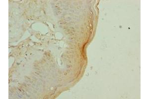 Immunohistochemistry of paraffin-embedded human skin tissue using ABIN7152281 at dilution of 1:100 (EXOSC1 antibody  (AA 9-195))