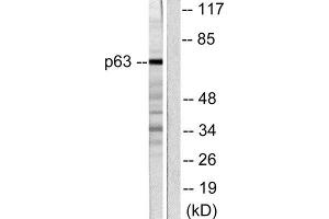 Western Blotting (WB) image for anti-T-Complex 1 (TCP1) (C-Term) antibody (ABIN1848723) (TCP1 alpha/CCTA antibody  (C-Term))