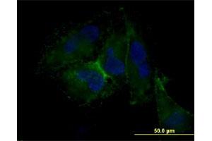 Immunofluorescence of monoclonal antibody to CD44 on HepG2 cell.