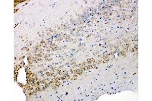IHC-P: Syndecan 3 antibody testing of rat brain tissue (SDC3 antibody  (N-Term))