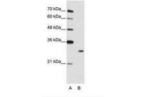 Image no. 1 for anti-Muscleblind-like Protein 1 (MBNL1) (C-Term) antibody (ABIN202283) (MBNL1 antibody  (C-Term))