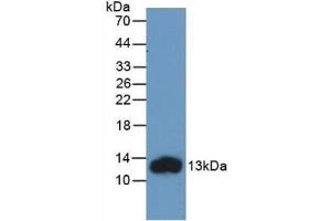 Detection of Recombinant FABP1, Human using Monoclonal Antibody to Fatty Acid Binding Protein 1 (FABP1) (FABP1 antibody  (AA 2-127))