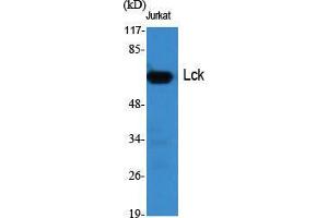 Western Blot (WB) analysis of specific cells using Lck Polyclonal Antibody. (LCK antibody  (Ser736))