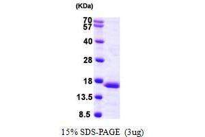 SDS-PAGE (SDS) image for Prefoldin Subunit 6 (PFDN6) (AA 1-129) protein (His tag) (ABIN667890)