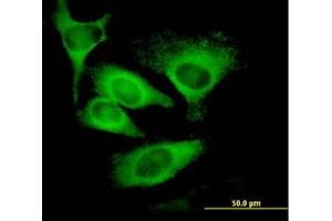 Image no. 1 for anti-Eukaryotic Translation Initiation Factor 5 (EIF5) (AA 1-432) antibody (ABIN598657) (EIF5 antibody  (AA 1-432))