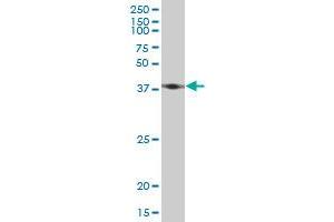 ACTB monoclonal antibody (M03), clone 1E7. (beta Actin antibody  (AA 1-375))