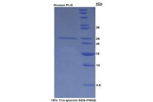 SDS-PAGE (SDS) image for Filaggrin (FLG) (AA 3905-4031) protein (His tag) (ABIN1079565) (Filaggrin Protein (FLG) (AA 3905-4031) (His tag))