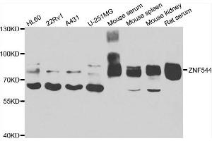 Western blot analysis of extracts of various cell lines, using ZNF544 antibody.
