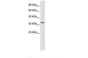 Image no. 2 for anti-Zinc Finger Protein 134 (ZNF134) (AA 128-177) antibody (ABIN203066)