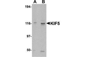 Western Blotting (WB) image for anti-Kinesin Family Member 5A (KIF5A) (C-Term) antibody (ABIN1030467) (KIF5A antibody  (C-Term))