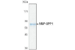 10% SDS-PAGE stained with Coomassie Blue (CB) and peptide fingerprinting by MALDI-TOF mass spectrometry (Osteopontin Protein (AA 1-300) (MBP tag))