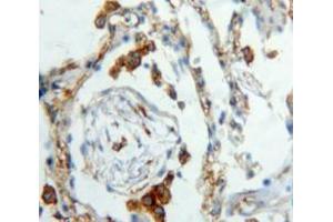 IHC-P analysis of Lung tissue, with DAB staining. (XCL1 antibody  (AA 23-113))