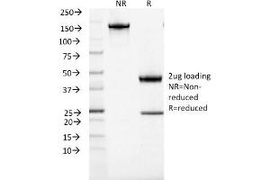 SDS-PAGE Analysis Purified ACTH Mouse Recombinant Monoclonal Antibody (rCLIP/1407). (POMC antibody  (AA 25-39))
