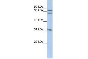 Gephyrin antibody used at 1 ug/ml to detect target protein. (Gephyrin antibody  (Middle Region))