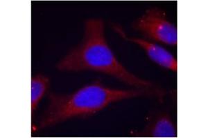Image no. 2 for anti-Protein-tyrosine Phosphatase 1C (PTPN6) (pTyr536) antibody (ABIN319255)