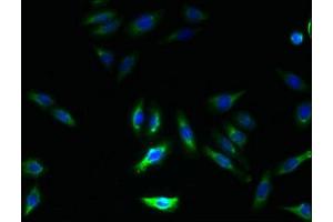 Immunofluorescence (IF) image for anti-Growth Hormone Inducible Transmembrane Protein (GHITM) (AA 293-345) antibody (ABIN7154521)