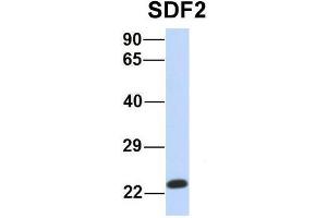 Host:  Rabbit  Target Name:  SDF2  Sample Type:  Human MCF7  Antibody Dilution:  1. (SDF2 antibody  (Middle Region))