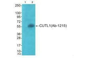 Western blot analysis of extracts from COS7 cells (Lane 2), using APLF (Ab-116) antiobdy. (APLF antibody  (Ser116))