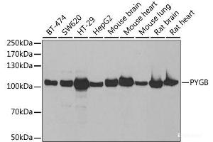 Western blot analysis of extracts of various cell lines using PYGB Polyclonal Antibody at dilution of 1:1000. (PYGB antibody)
