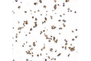 Immunocytochemistry (ICC) image for anti-Carcinoembryonic Antigen-Related Cell Adhesion Molecule 1/5 (CEACAM1/5) (AA 35-433) antibody (ABIN7455139) (Recombinant CEACAM1/5 antibody  (AA 35-433))