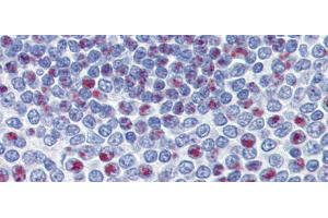 Immunohistochemistry (IHC) image for anti-Forkhead Box M1 (FOXM1) (Middle Region) antibody (ABIN2792172)