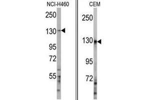 Image no. 1 for anti-Ubiquitination Factor E4A (UBE4A) (C-Term) antibody (ABIN357482) (UBE4A antibody  (C-Term))