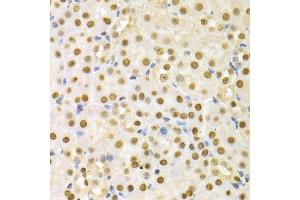 Immunohistochemistry of paraffin-embedded mouse kidney using SFN Antibody. (14-3-3 sigma/SFN antibody  (AA 1-248))