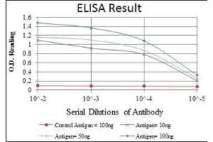 Red: Control Antigen (100 ng), Purple: Antigen (10 ng), Green: Antigen (50 ng), Blue: Antigen (100 ng), (TNNI2 antibody)