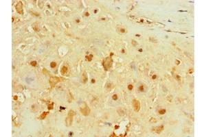 Immunohistochemistry of paraffin-embedded human placenta tissue using ABIN7156651 at dilution of 1:100 (IFIH1 antibody  (AA 700-1025))