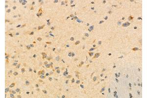 ABIN6260084 and ABIN6273196 at 1/100 staining Mouse brain tissue by IHC-P.