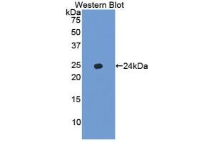 Western blot analysis of the recombinant protein. (Chemokine (C-X-C Motif) Ligand 15 (CXCL15) (AA 26-167) antibody)