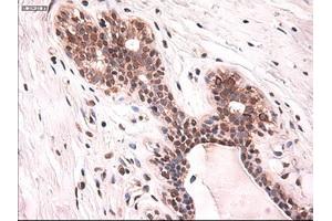 Immunohistochemical staining of paraffin-embedded breast using anti-KRT18 (ABIN2452674) mouse monoclonal antibody. (Cytokeratin 18 antibody  (AA 69-372))