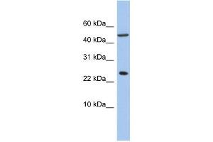WB Suggested Anti-ANKRD7 Antibody Titration: 0. (ANKRD7 antibody  (Middle Region))