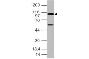 Image no. 1 for anti-DEAD (Asp-Glu-Ala-Asp) Box Polypeptide 58 (DDX58) (AA 1-220) antibody (ABIN5027276) (DDX58 antibody  (AA 1-220))