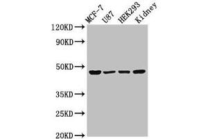 Western Blot Positive WB detected in: MCF-7 whole cell lysate, U87 whole cell lysate, HEK293 whole cell lysate, Rat kidney tissue All lanes: WWOX antibody at 3 μg/mL Secondary Goat polyclonal to rabbit IgG at 1/50000 dilution Predicted band size: 47, 42, 22, 5, 27, 36, 24 kDa Observed band size: 47 kDa (WWOX antibody  (AA 1-180))