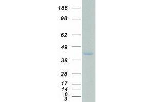 Western Blotting (WB) image for Single-Stranded DNA Binding Protein 2 (SSBP2) protein (Myc-DYKDDDDK Tag) (ABIN2732692)