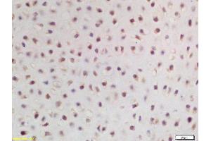 Formalin-fixed and paraffin embedded mouse embryo labeled with Rabbit Anti ZNF268 Polyclonal Antibody, Unconjugated  at 1:200 followed by conjugation to the secondary antibody and DAB staining