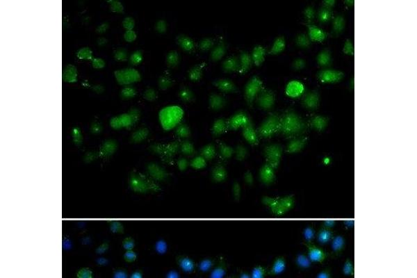 MCM10 antibody